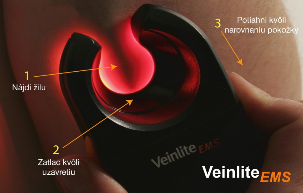 Veinlite_upravene